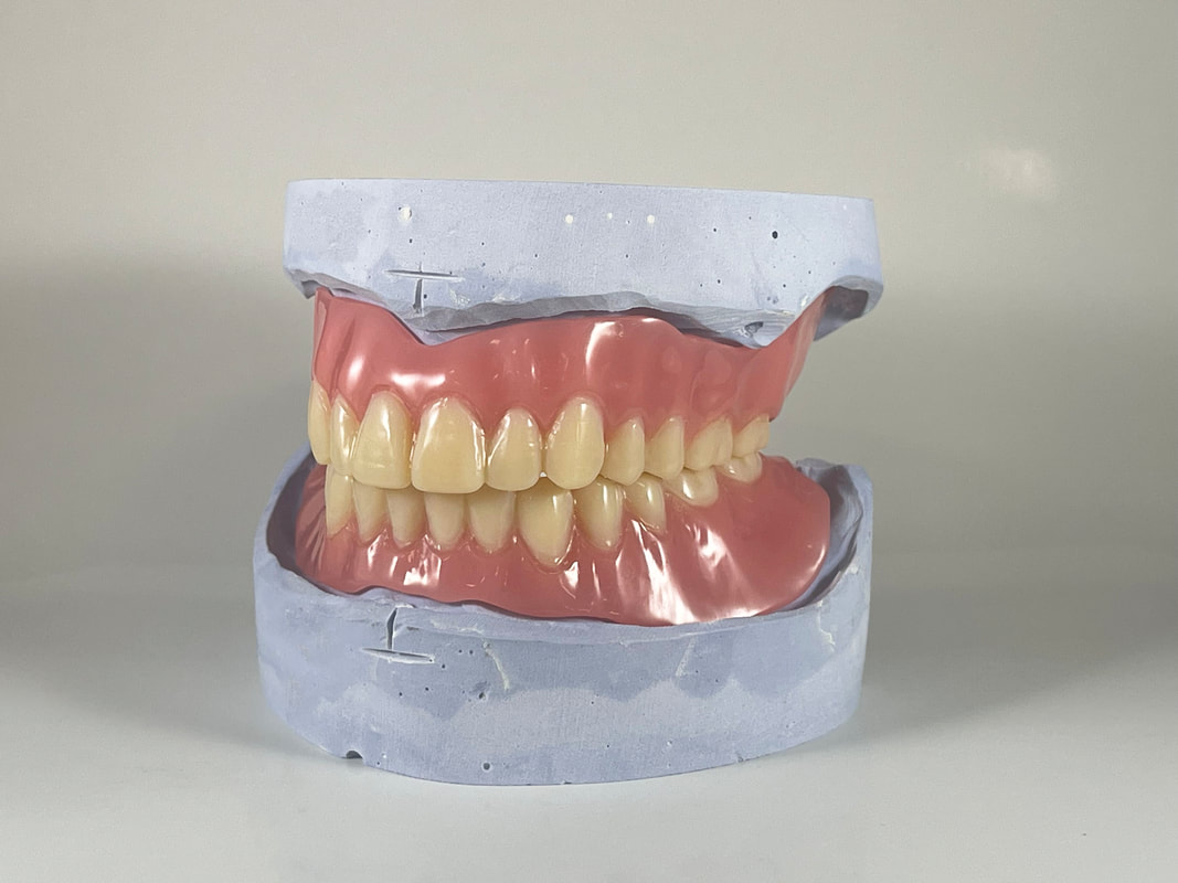 Best Denture Making Materials: Porcelain vs Acrylic