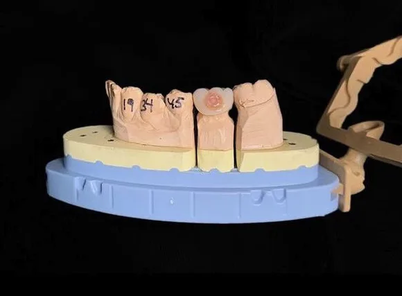 Dental Lab teeth model