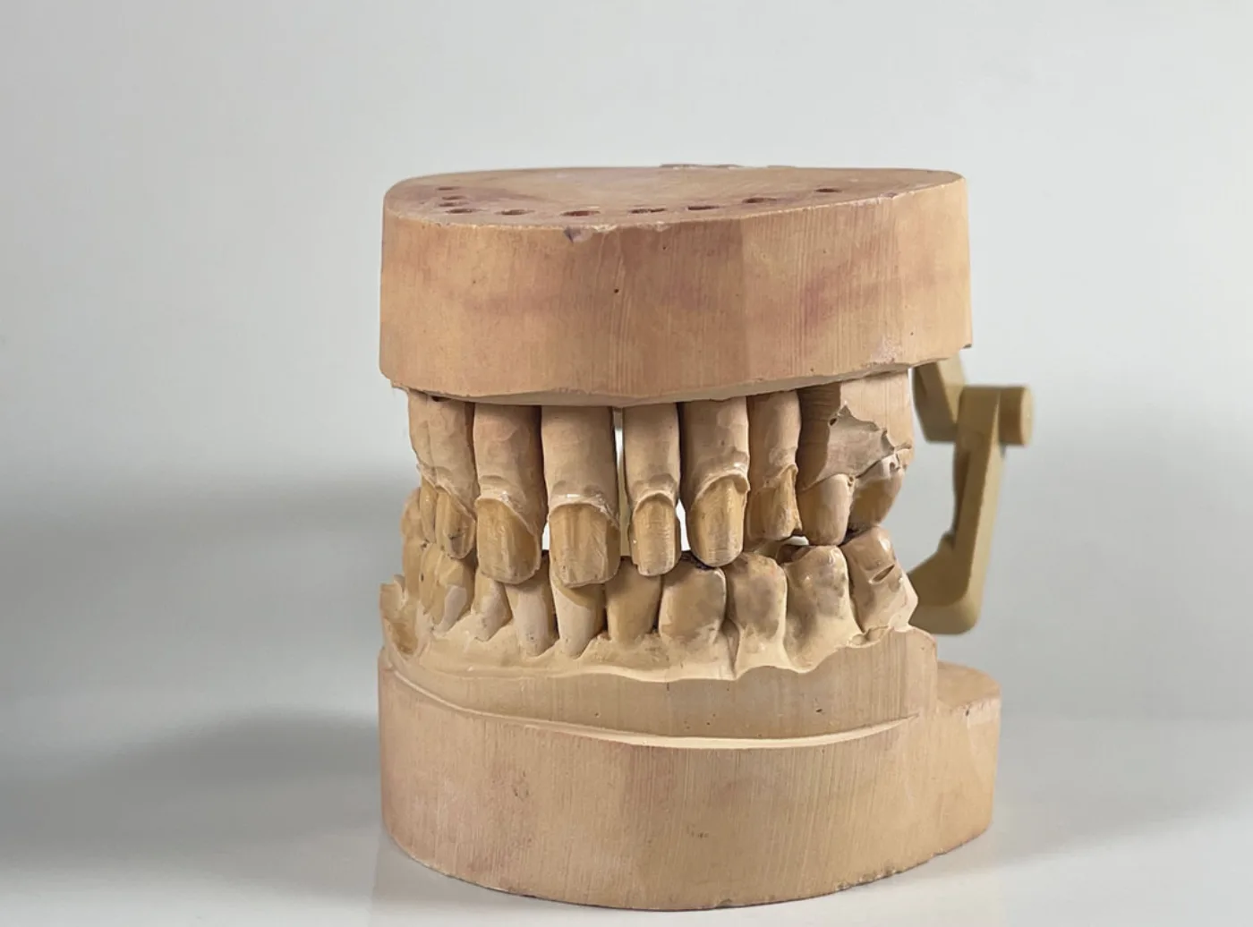 Image of dental veneers model