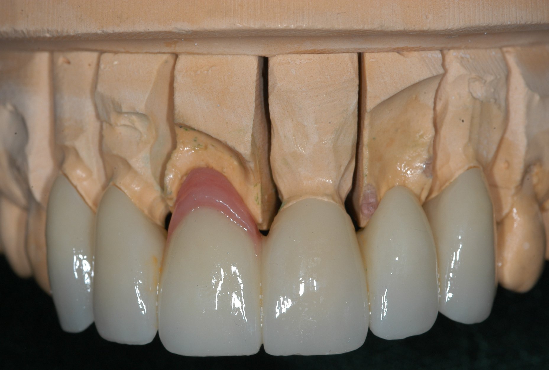 Image of dental prosthetics