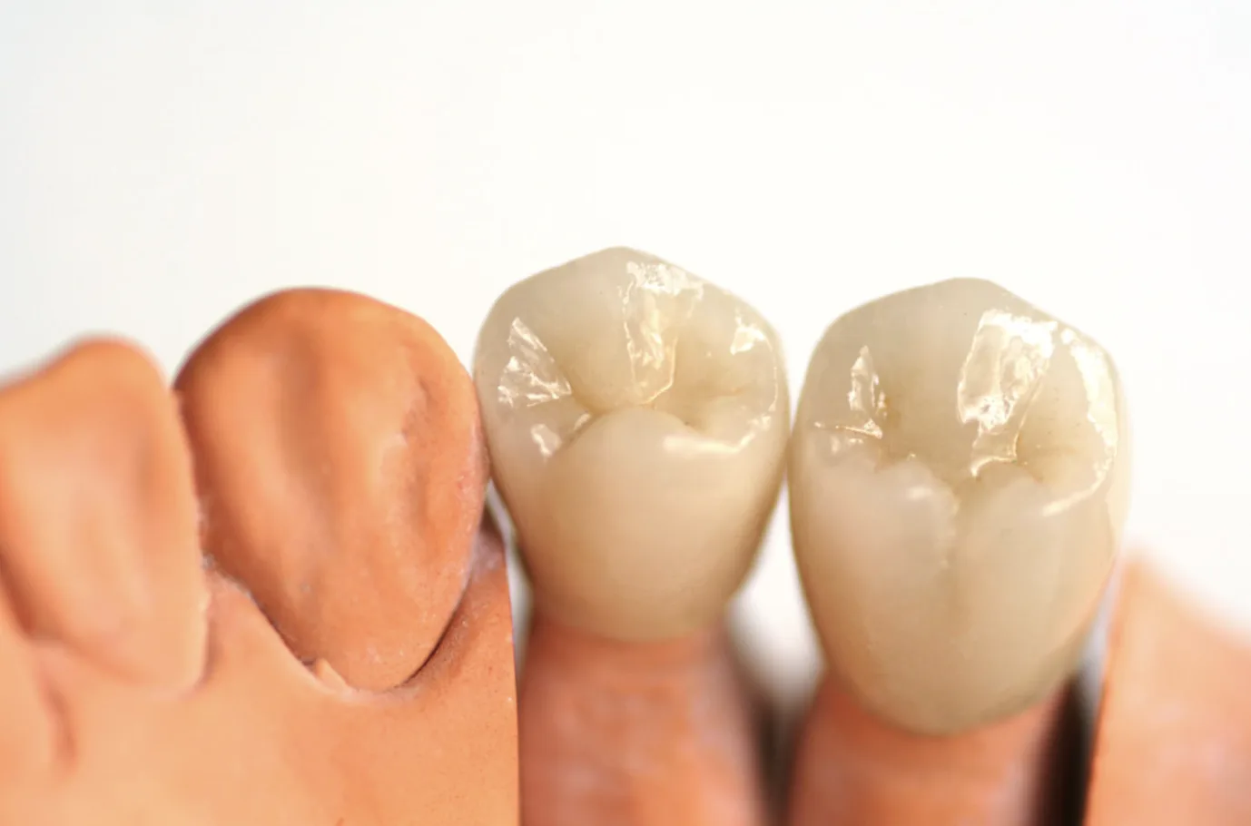 Dental Zirconia teeth model.