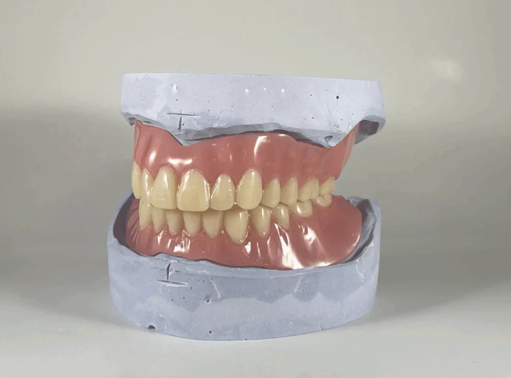 Model of dentures