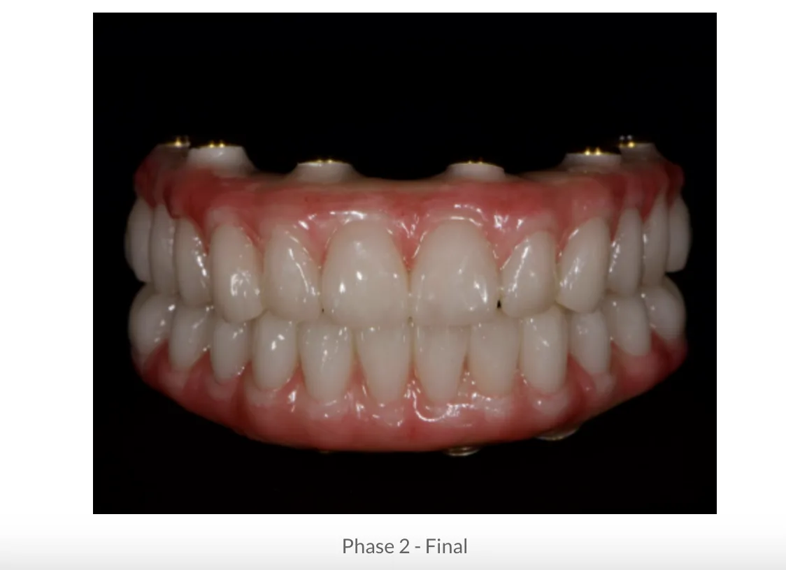 Image of teeth