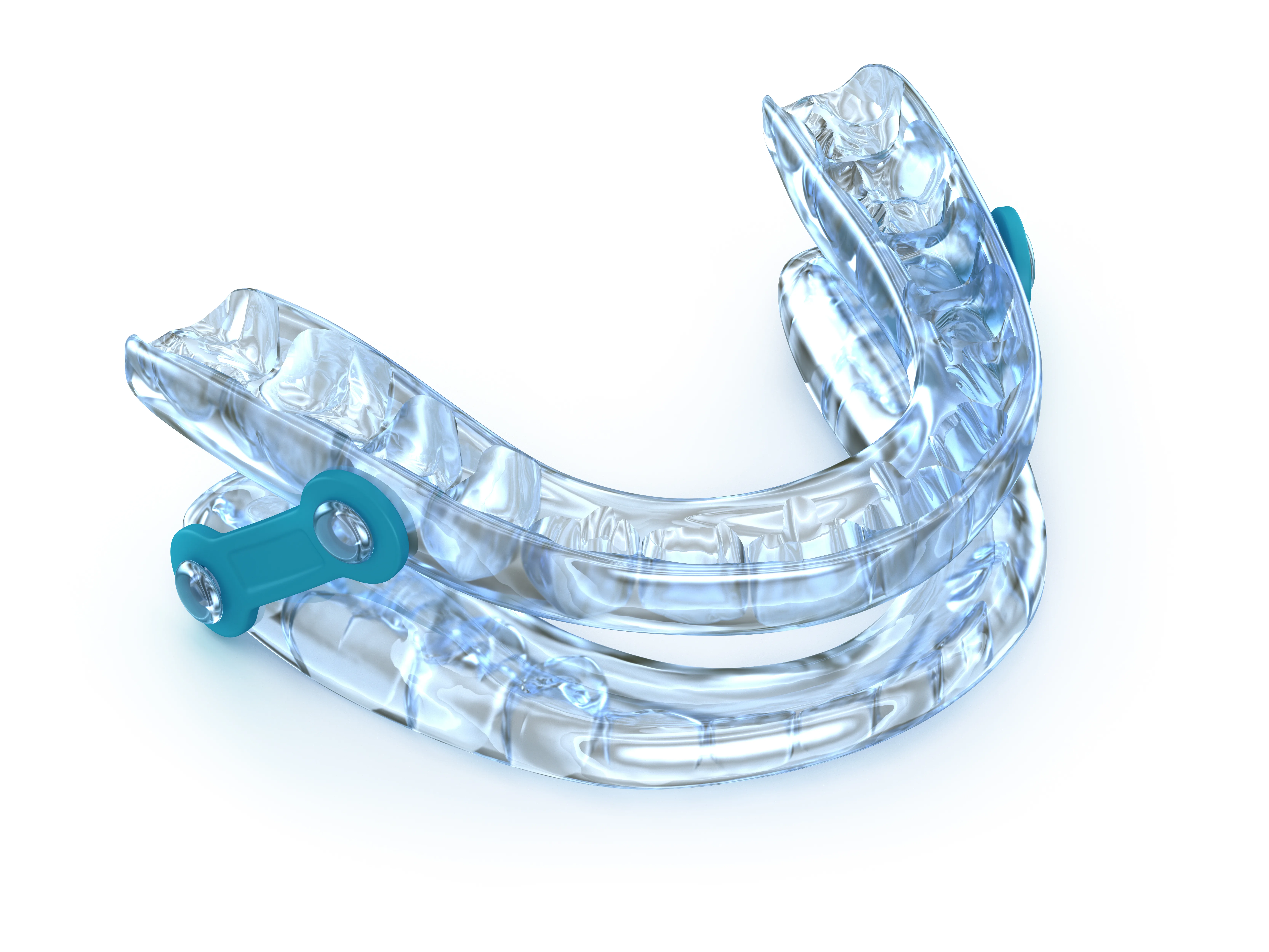 Image of oral appliance for sleep apnea.