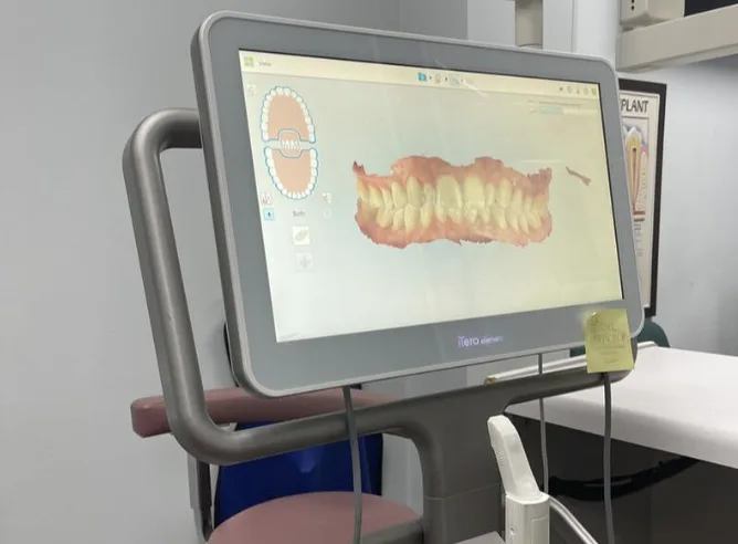 Image of iOS scan on a screen