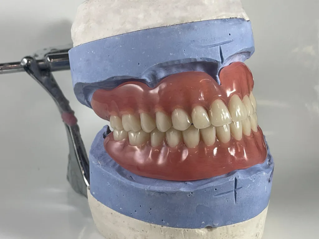 Model of dentures