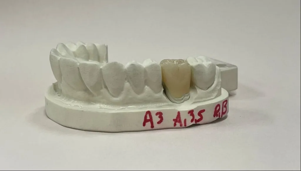 Model of lower teeth
