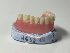 Dentures model