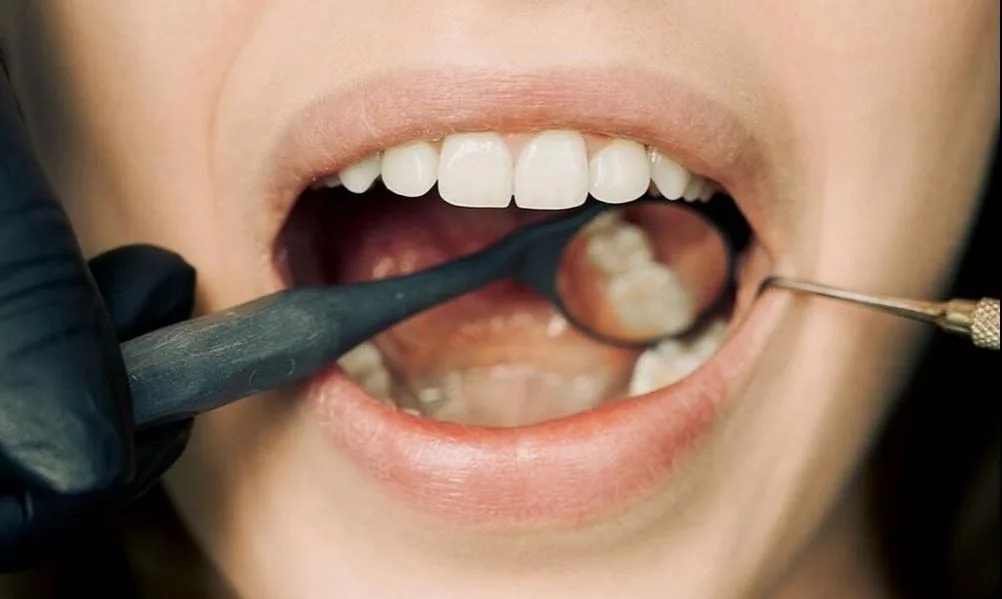 Patient undergoing oral exam